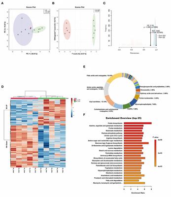 Tissue-specific metabolomic profiling after cardiopulmonary bypass in fetal sheep